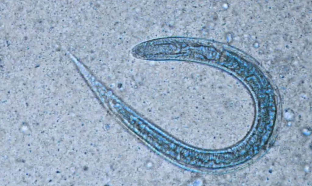 estrongiloidiasis